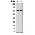 LifeSab™ NF-kappaB p100 (pS865) Rabbit pAb (50 µl)