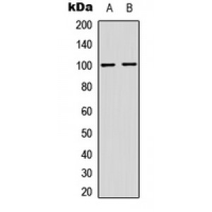 LifeSab™ NF-kappaB p100 (pS865) Rabbit pAb (50 µl)