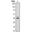 LifeSab™ Cyclin D1 Rabbit pAb (50 µl)