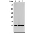 LifeSab™ Histone H3 (MonoMethyl R2) Rabbit pAb (50 µl)