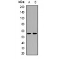 LifeSab™ p53 Rabbit pAb (50 µl)