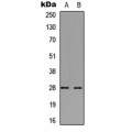 LifeSab™ cTnI Rabbit mAb (50 µl)