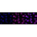 LifeSab™ ACVR2B Rabbit mAb (20 μl)