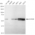 LifeSab™ ACVR2B Rabbit mAb (20 μl)