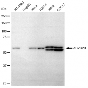 LifeSab™ ACVR2B Rabbit mAb (20 μl)