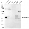 LifeSab™ PSMB10 Rabbit mAb (20 μl)