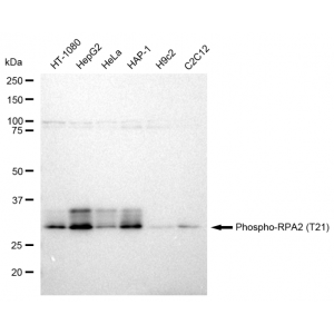 LifeSab™ Phospho-RPA2 (T21) Rabbit mAb (20 μl)