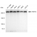 LifeSab™ PRPF8 Rabbit mAb (20 μl)