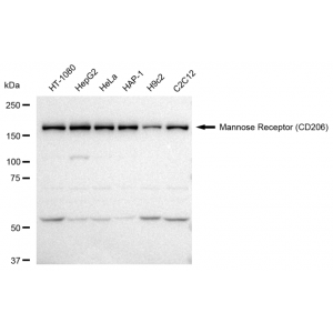 LifeSab™ CD206 Rabbit mAb (20 μl)