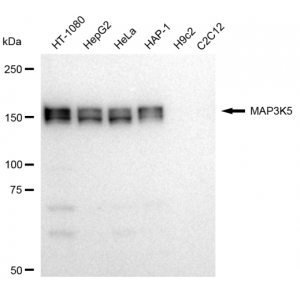 LifeSab™ MAP3K5 Rabbit mAb (20 μl)