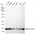 LifeSab™ PLA2G2A Rabbit mAb (20 μl)