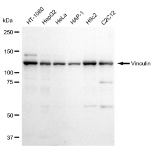 LifeSab™ VCL Rabbit mAb (20 μl)