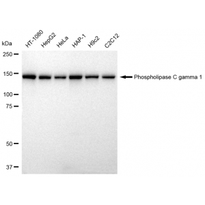 LifeSab™ PLCG1 Rabbit mAb (20 μl)