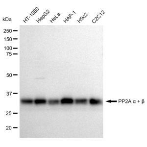 LifeSab™ PPP2CA Rabbit mAb (20 μl)