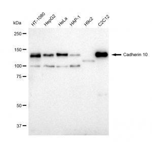 LifeSab™ Cadherin 10 Rabbit mAb (20 μl)