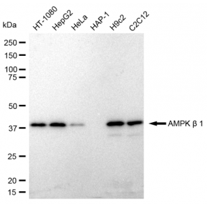 LifeSab™ PRKAB1 Rabbit mAb (20 μl)