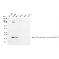 LifeSab™ CDKN2A Rabbit mAb (20 μl)