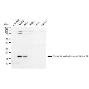 LifeSab™ CDKN2A Rabbit mAb (20 μl)