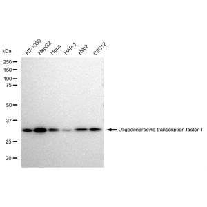 LifeSab™ CDKN2A Rabbit mAb (20 μl)