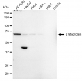 LifeSab™ Alpha fetoprotein Rabbit mAb (20 μl)