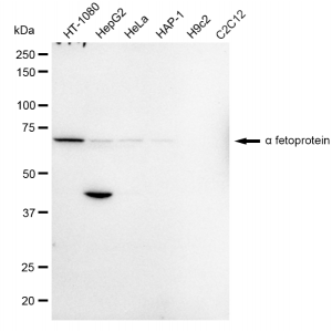 LifeSab™ Alpha fetoprotein Rabbit mAb (20 μl)