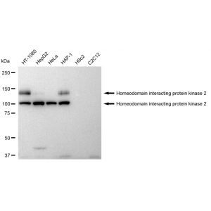 LifeSab™ HIPK2 Rabbit mAb (20 μl)