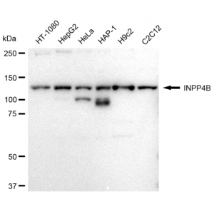 LifeSab™ INPP4B Rabbit mAb (20 μl)