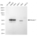 LifeSab™ Keratin 7 Rabbit mAb (20 μl)