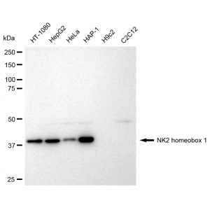 LifeSab™ TTF-1 Rabbit mAb (20 μl)