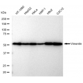 LifeSab™ Vimentin Rabbit mAb (20 μl)