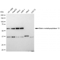 LifeSab™ MMP-13 Rabbit mAb (20 μl)