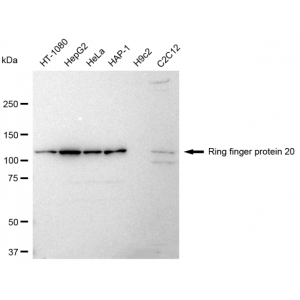 LifeSab™ RNF20 Rabbit mAb (20 μl)