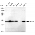 LifeSab™ SETD7 Rabbit mAb (20 μl)