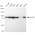 LifeSab™ SUZ12 Rabbit mAb (20 μl)