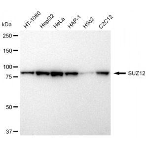 LifeSab™ SUZ12 Rabbit mAb (20 μl)