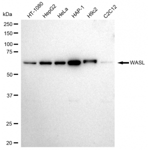 LifeSab™ WASL Rabbit mAb (20 μl)