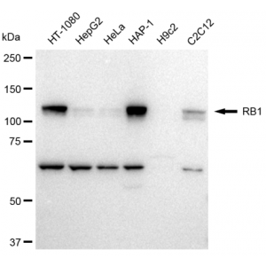 LifeSab™ RB1 Rabbit mAb (20 μl)