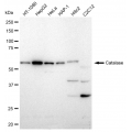 LifeSab™ Catalase Rabbit mAb (20 μl)