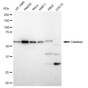 LifeSab™ Catalase Rabbit mAb (20 μl)