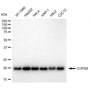 LifeSab™ COPS8 Rabbit mAb (20 μl)