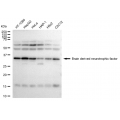 LifeSab™ BDNF Rabbit mAb (20 μl)