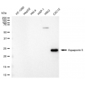 LifeSab™ AQP5 Rabbit mAb (20 μl)