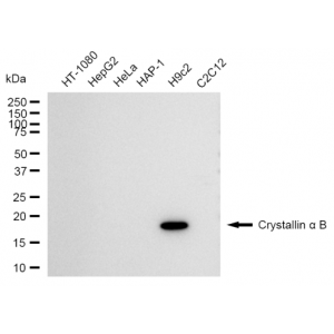 LifeSab™ CRYAB Rabbit mAb (20 μl)