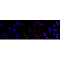 LifeSab™ DDR2 Rabbit mAb (20 μl)