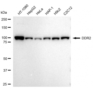 LifeSab™ DDR2 Rabbit mAb (20 μl)