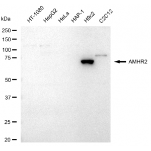 LifeSab™ AMHR2 Rabbit mAb (20 μl)