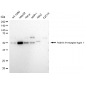 LifeSab™ ACVR1 Rabbit mAb (20 μl)