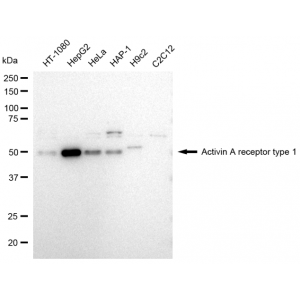 LifeSab™ ACVR1 Rabbit mAb (20 μl)