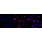 LifeSab™ BDKRB2 Rabbit mAb (20 μl)