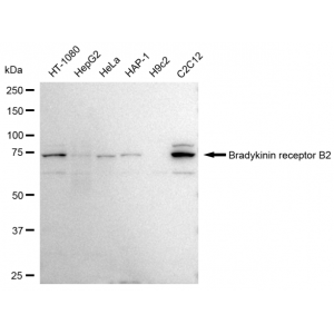 LifeSab™ BDKRB2 Rabbit mAb (20 μl)